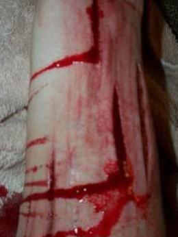*mutilation*